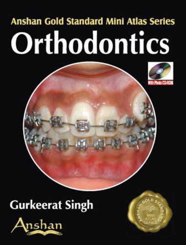 Cover for Singh · Mini Atlas of Orthodontics (Anshan Gold Standard Mini Atlas) (Paperback Book) (2009)