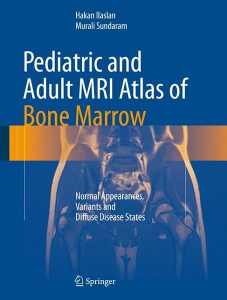 Cover for Hakan Ilaslan · Pediatric and Adult MRI Atlas of Bone Marrow: Normal Appearances, Variants and Diffuse Disease States (Gebundenes Buch) [1st ed. 2016 edition] (2016)
