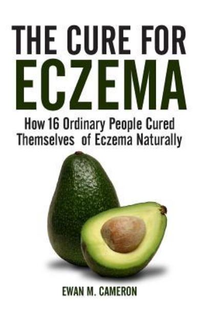 Cover for Ewan M Cameron · The Cure for Eczema (Hardcover Book) (2017)