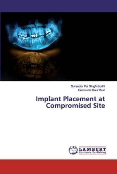 Implant Placement at Compromised - Sodhi - Books -  - 9786200256393 - September 24, 2019