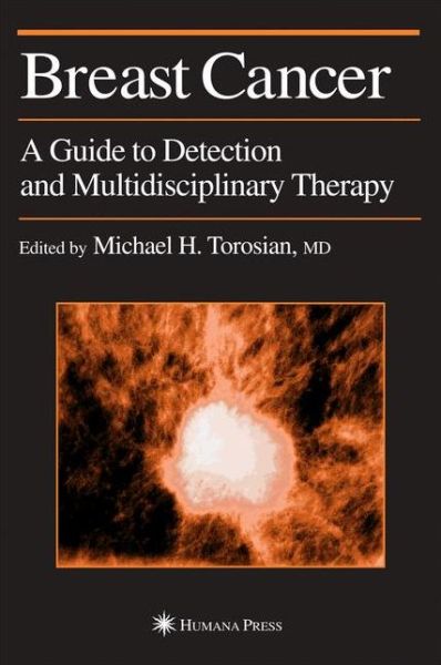 Cover for Michael H Torosian · Breast Cancer: A Guide to Detection and Multidisciplinary Therapy - Current Clinical Oncology (Gebundenes Buch) [2002 edition] (2002)