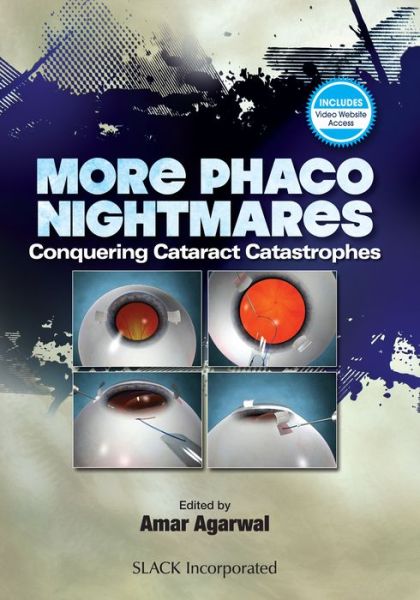 Cover for Amar Agarwal · More Phaco Nightmares: Conquering Cataract Catastrophes (Hardcover Book) (2018)