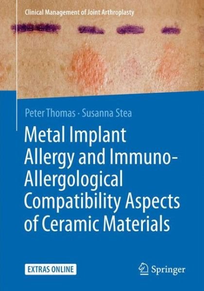 Cover for Peter Thomas · Metal Implant Allergy and Immuno-Allergological Compatibility Aspects of Ceramic Materials (Paperback Bog) [2015 edition] (2015)