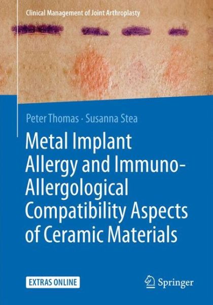 Metal Implant Allergy and Immuno-Allergological Compatibility Aspects of Ceramic Materials - Peter Thomas - Books - Springer-Verlag Berlin and Heidelberg Gm - 9783662474396 - July 6, 2015