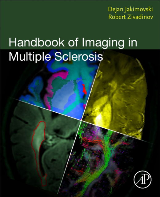 Handbook of Imaging in Multiple Sclerosis (Paperback Book) (2024)