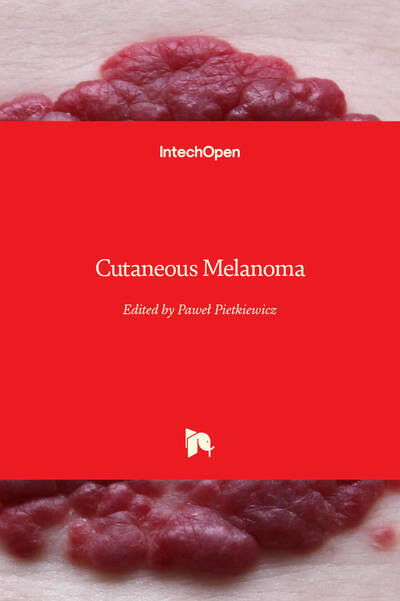 Cover for Pawel Pietkiewicz · Cutaneous Melanoma (Hardcover Book) (2020)