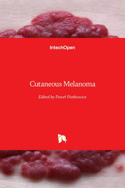 Cutaneous Melanoma - Pawel Pietkiewicz - Books - IntechOpen - 9781789841398 - May 27, 2020