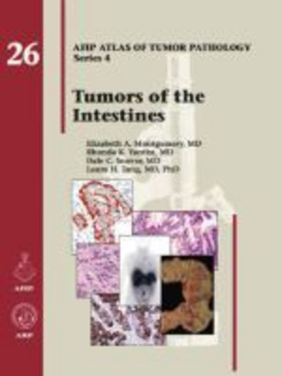 Cover for Elizabeth A. Montgomery · Tumors of the Intestines - AFIP Atlas of Tumor Pathology, Series 4, (Hardcover Book) (2017)