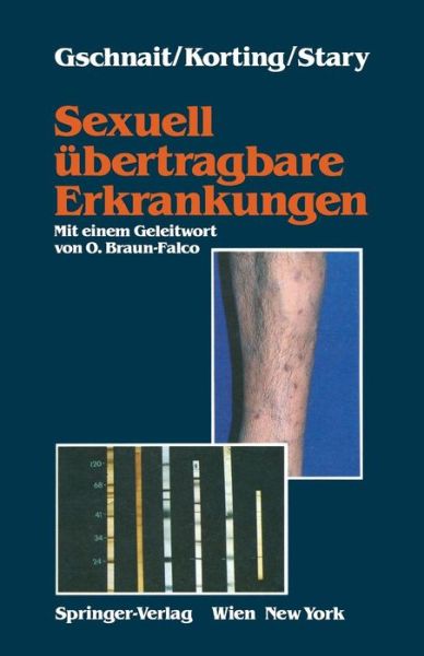 Sexuell UEbertragbare Erkrankungen - Fritz Gschnait - Books - Springer Verlag GmbH - 9783211821398 - January 15, 1990