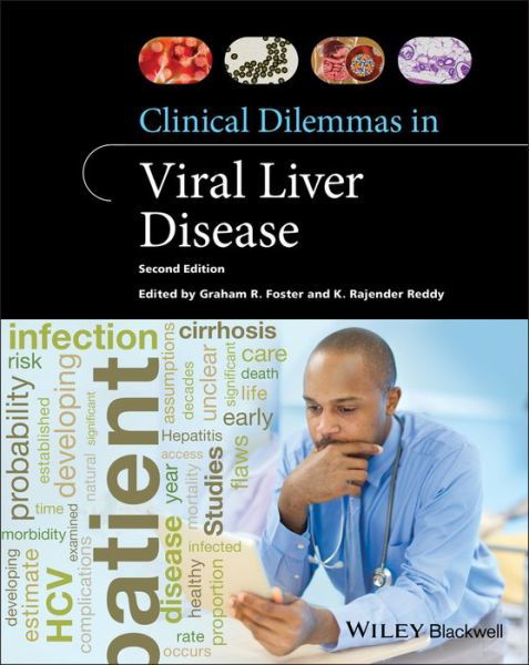 Clinical Dilemmas in Viral Liver Disease - Clinical Dilemmas (UK) - KR Reddy - Boeken - John Wiley and Sons Ltd - 9781119533399 - 22 april 2020