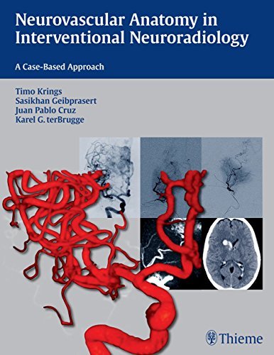 Cover for Timo Krings · Neurovascular Anatomy in Interventional Neuroradiology: A Case-Based Approach (Pocketbok) (2015)