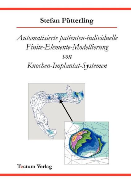 Cover for Stefan Futterling · Automatisierte patienten-individuelle Finite-Elemente-Modellierung von Knochen-Implantat-Systemen (Paperback Book) [German edition] (2011)