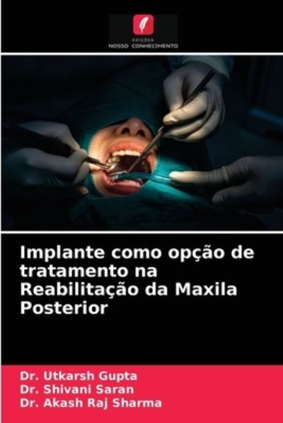 Cover for Dr Utkarsh Gupta · Implante como opcao de tratamento na Reabilitacao da Maxila Posterior (Paperback Book) (2021)