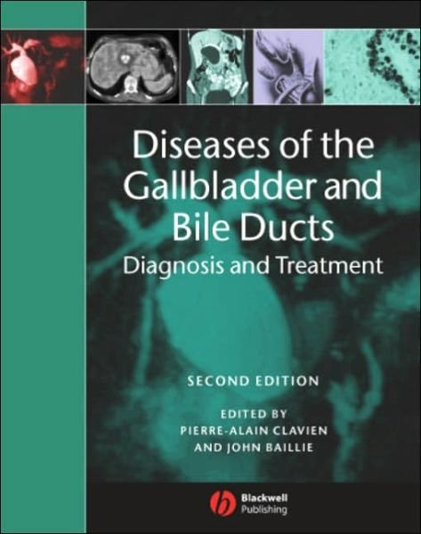 Cover for PA Clavien · Diseases of the Gallbladder and Bile Ducts (Hardcover Book) [2nd edition] (2006)
