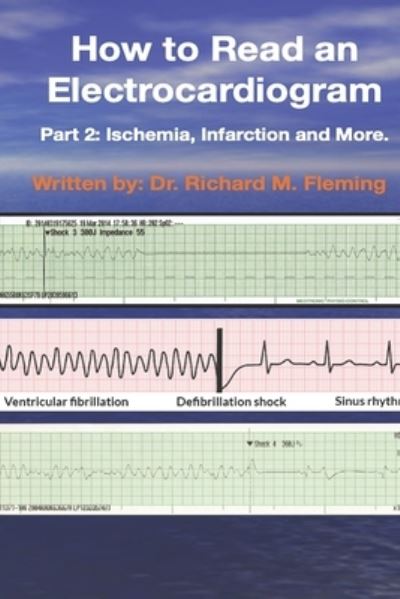 How to Read an Electrocardiogram - Richard M Fleming - Livros - Independently Published - 9798567254400 - 18 de novembro de 2020