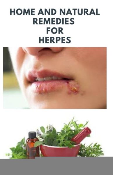 Cover for Dr Elizabeth David · Home and Natural Remedies for Herpes (Paperback Book) (2020)