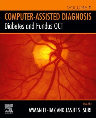 Cover for Ayman S. El-Baz · Diabetes and Fundus OCT - Computer-Assisted Diagnosis (Paperback Book) (2020)