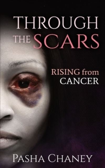 Cover for Pasha Chaney · Through the Scars: Rising from Cancer (Paperback Book) (2020)