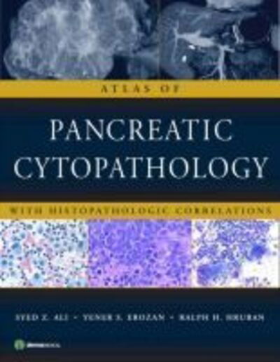 Atlas of Pancreatic Cytopathology: With Histopathologic Correlations - Syed Ali - Livros - Demos Medical Publishing - 9781933864402 - 6 de março de 2009