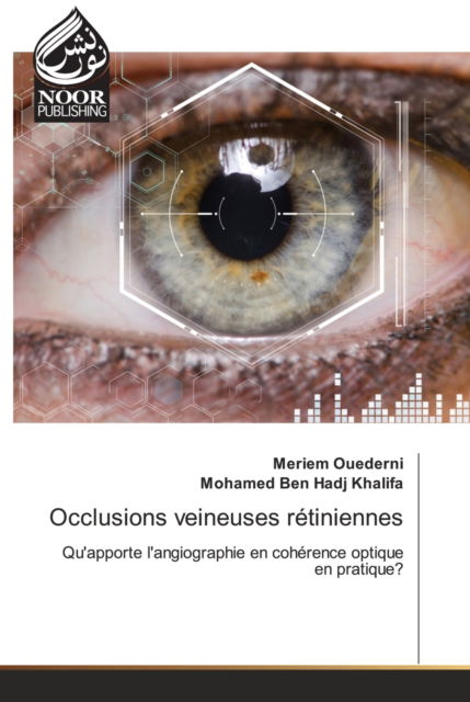 Occlusions veineuses retiniennes - Meriem Ouederni - Books - Noor Publishing - 9786203858402 - August 9, 2021