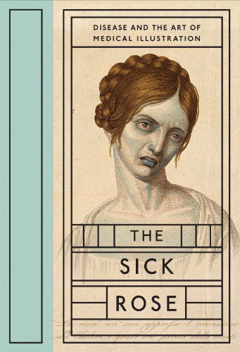 The Sick Rose: Disease and the Art of Medical Illustration - Richard Barnett - Books - D.A.P./Distributed Art Publishers, Inc. - 9781938922404 - May 31, 2014