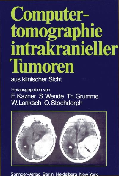 Cover for E Kazner · Computertomographie Intrakranieller Tumoren aus Klinischer Sicht (Paperback Bog) [Softcover Reprint of the Original 1st 1981 edition] (1981)
