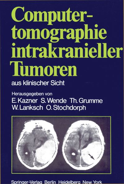 Computertomographie Intrakranieller Tumoren aus Klinischer Sicht - E Kazner - Books - Springer-Verlag Berlin and Heidelberg Gm - 9783540105404 - April 1, 1981