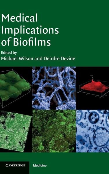 Cover for Michael Wilson · Medical Implications of Biofilms (Hardcover bog) (2003)