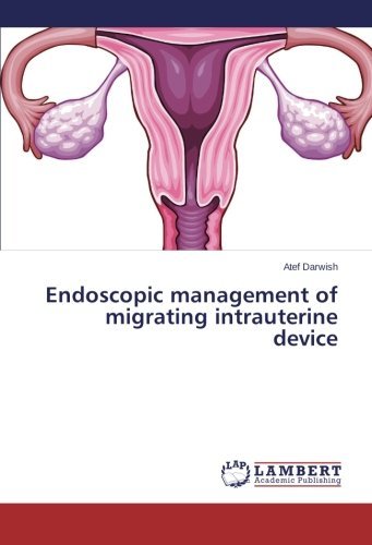 Cover for Atef Darwish · Endoscopic Management of Migrating Intrauterine Device (Paperback Bog) (2014)