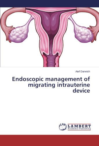 Cover for Atef Darwish · Endoscopic Management of Migrating Intrauterine Device (Paperback Book) (2014)