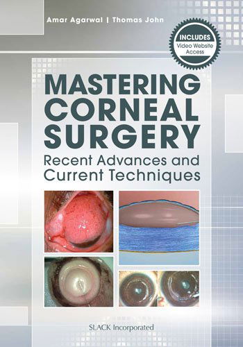 Cover for Amar Agarwal · Mastering Corneal Surgery: Recent Advances and Current Techniques (Paperback Book) (2014)