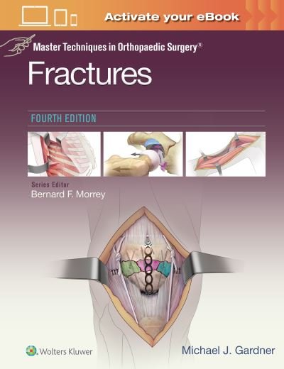 Cover for Michael J. Gardner · Master Techniques in Orthopaedic Surgery: Fractures - Master Techniques in Orthopaedic Surgery (Hardcover bog) (2020)
