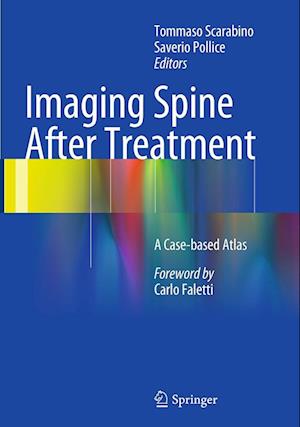 Cover for Imaging Spine After Treatment: A Case-based Atlas (Paperback Book) [Softcover reprint of the original 1st ed. 2014 edition] (2016)