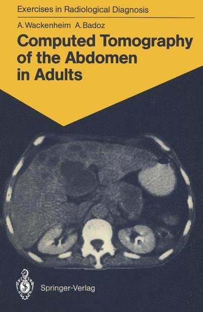 Cover for Auguste Wackenheim · Computed Tomography of the Abdomen in Adults: 85 Radiological Exercises for Students and Practitioners - Exercises in Radiological Diagnosis (Paperback Bog) [Softcover reprint of the original 1st ed. 1988 edition] (1988)