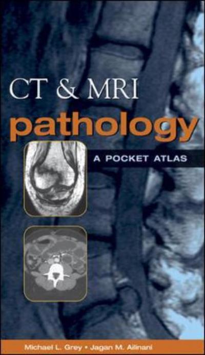 CT & MRI Pathology - Michael Grey - Kirjat - McGraw-Hill Education - Europe - 9780071380409 - perjantai 16. toukokuuta 2003