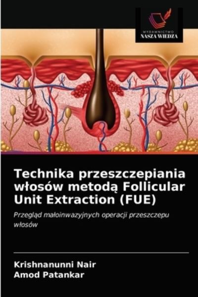 Cover for Krishnanunni Nair · Technika przeszczepiania wlosow metod? Follicular Unit Extraction (FUE) (Paperback Book) (2021)