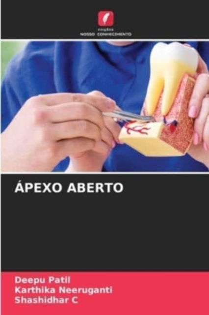 Cover for Deepu Patil · Apexo Aberto (Paperback Book) (2021)