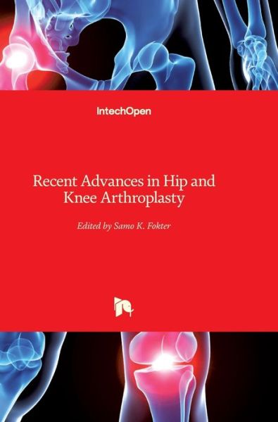 Cover for Samo Fokter · Recent Advances in Hip and Knee Arthroplasty (Hardcover Book) (2012)