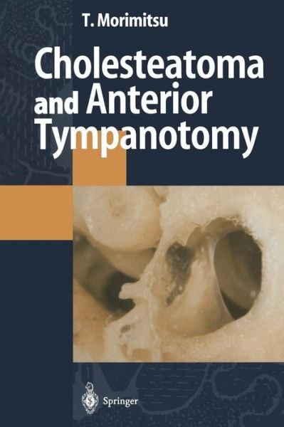 Cover for Tamotsu Morimitsu · Cholesteatoma and Anterior Tympanotomy (Pocketbok) [Softcover reprint of the original 1st ed. 1997 edition] (2012)