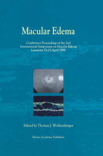 Cover for T J Wolfensberger · Macular Edema: Conference Proceedings of the 2nd International Symposium on Macular Edema, Lausanne, 23-25 April 1998 (Hardcover Book) [Reprinted from DOCUMENTA OPHTHALMOLOGICA, 97:3-4, edition] (2000)