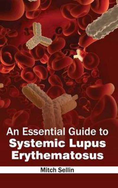 Cover for Mitch Sellin · An Essential Guide to Systemic Lupus Erythematosus (Hardcover Book) (2015)