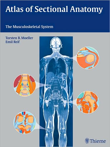 Cover for Torsten Bert Moller · Atlas of Sectional Anatomy: The Musculoskeletal System (Hardcover Book) [New edition] (2009)