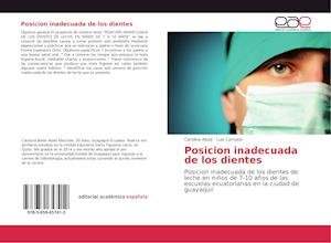 Cover for Abad · Posicion inadecuada de los dientes (Bok)