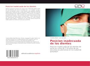 Cover for Abad · Posicion inadecuada de los dientes (Book)