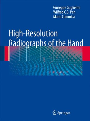 Cover for Giuseppe Guglielmi · High-Resolution Radiographs of the Hand (Paperback Book) [Softcover reprint of hardcover 1st ed. 2009 edition] (2010)