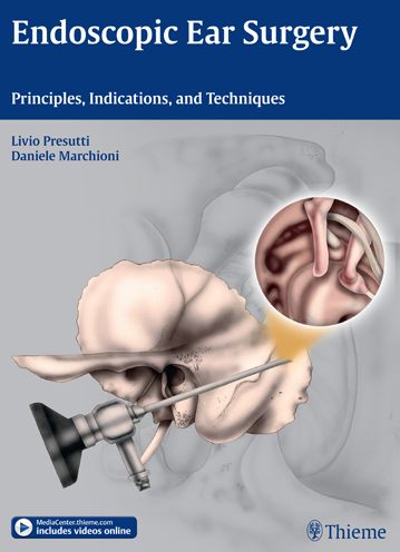 Cover for Livio Presutti · Endoscopic Ear Surgery: Principles, Indications, and Techniques (Gebundenes Buch) (2014)