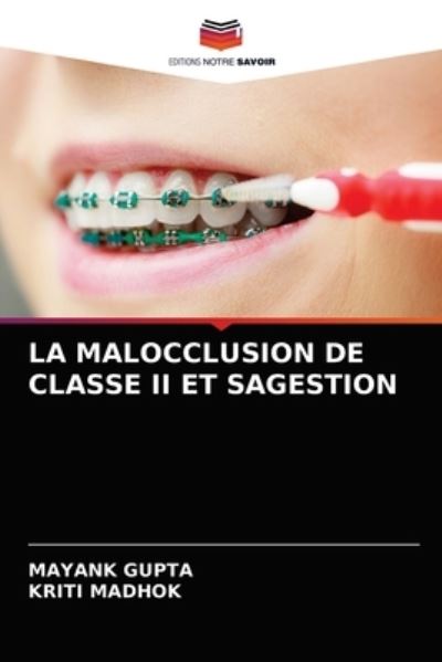 Cover for Mayank Gupta · La Malocclusion de Classe II Et Sagestion (Paperback Book) (2021)