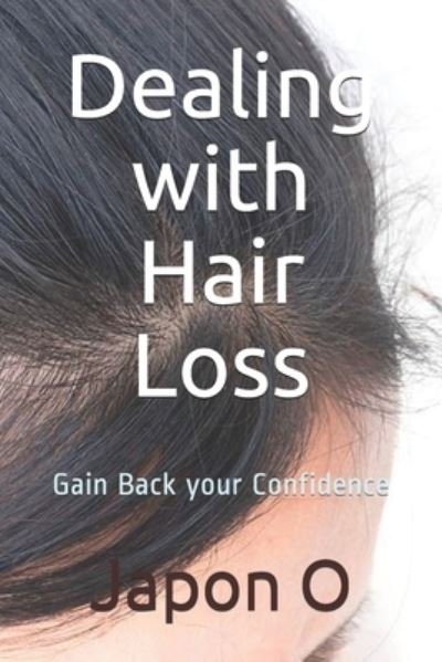 Cover for Japon O · Dealing with Hair Loss (Pocketbok) (2020)