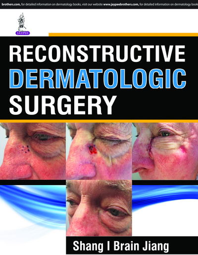 Cover for S Brian Jiang · Reconstructive Dermatologic Surgery (Gebundenes Buch) (2018)