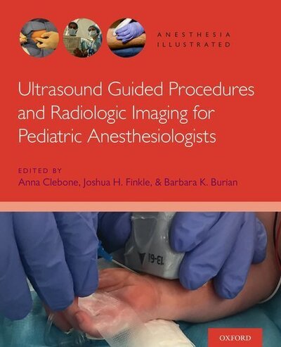 Ultrasound Guided Procedures and Radiologic Imaging for Pediatric Anesthesiologists - Anesthesia Illustrated -  - Kirjat - Oxford University Press Inc - 9780190081416 - keskiviikko 13. lokakuuta 2021
